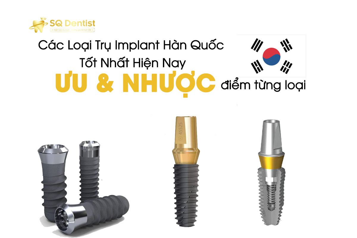 Các Loại Trụ Implant Hàn Quốc Tốt Nhất Hiện Nay Ưu và nhược điểm từng