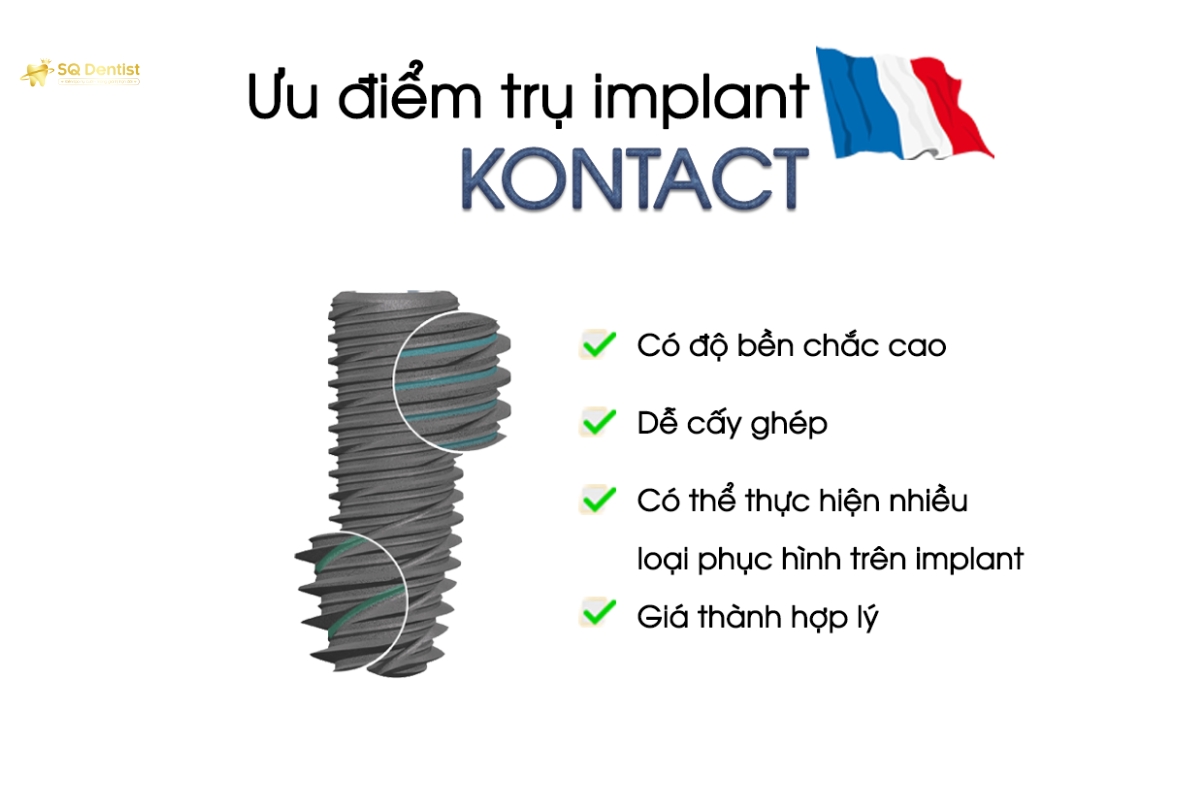 tru-implant-kontact-phap