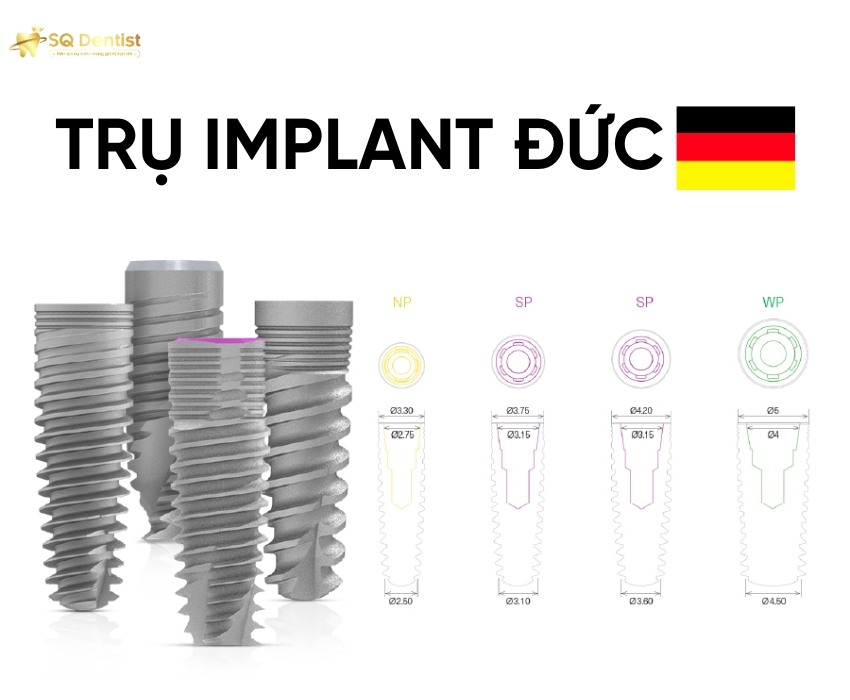 Trụ implant Đức là giải pháp cấy ghép nha khoa cao cấp