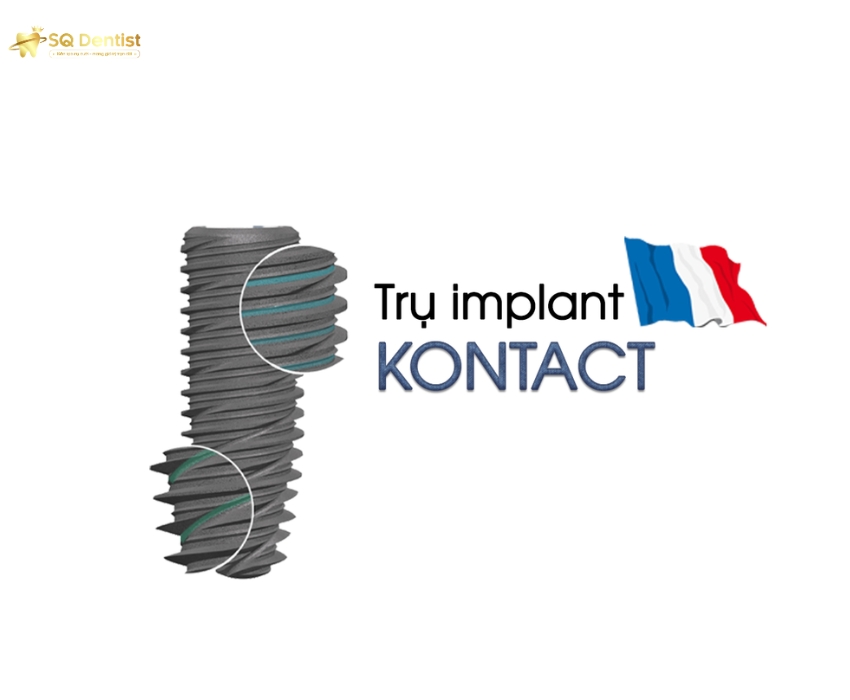 Trụ Implant Kontact được sản xuất tại Pháp