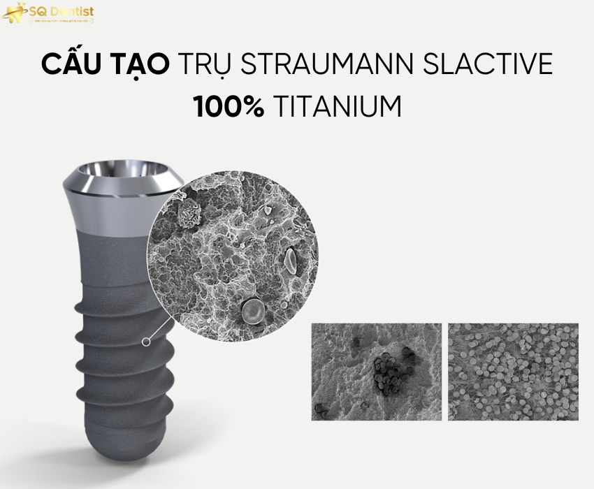 cấu trạo trụ implant Straumann SLActive đảm bảo quá trình cấy ghép nhanh chóng và hiệu quả